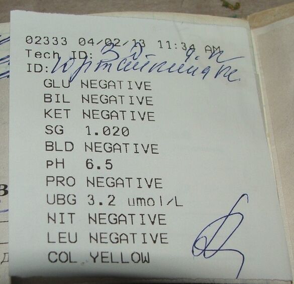 İdrar analizim femiksiden önce